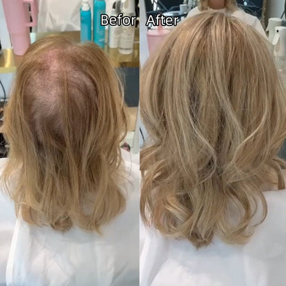 Summer Sale｜Lightweight Wavy Hair Topper